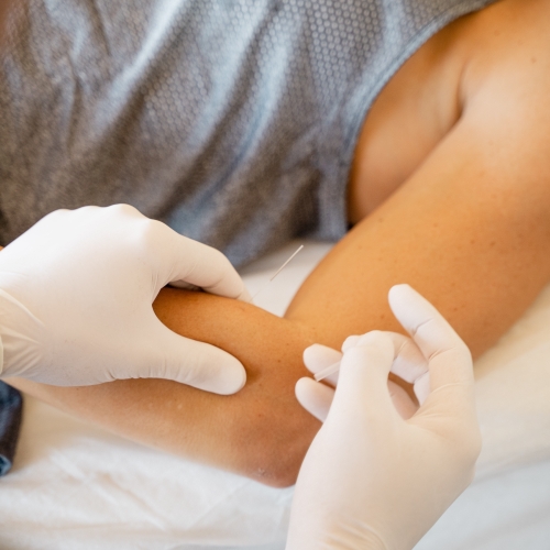 physiotherapy-center-gunn-ims-expert-physio-plus-gloucester-orleans-on