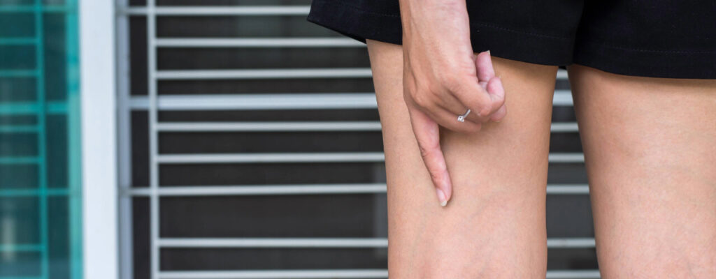 Understanding Post-Surgical Swelling: What’s Normal